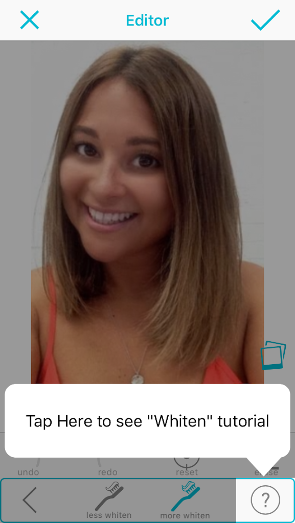 Teeth Whitening – Selfie Editor for iPhone/iPad